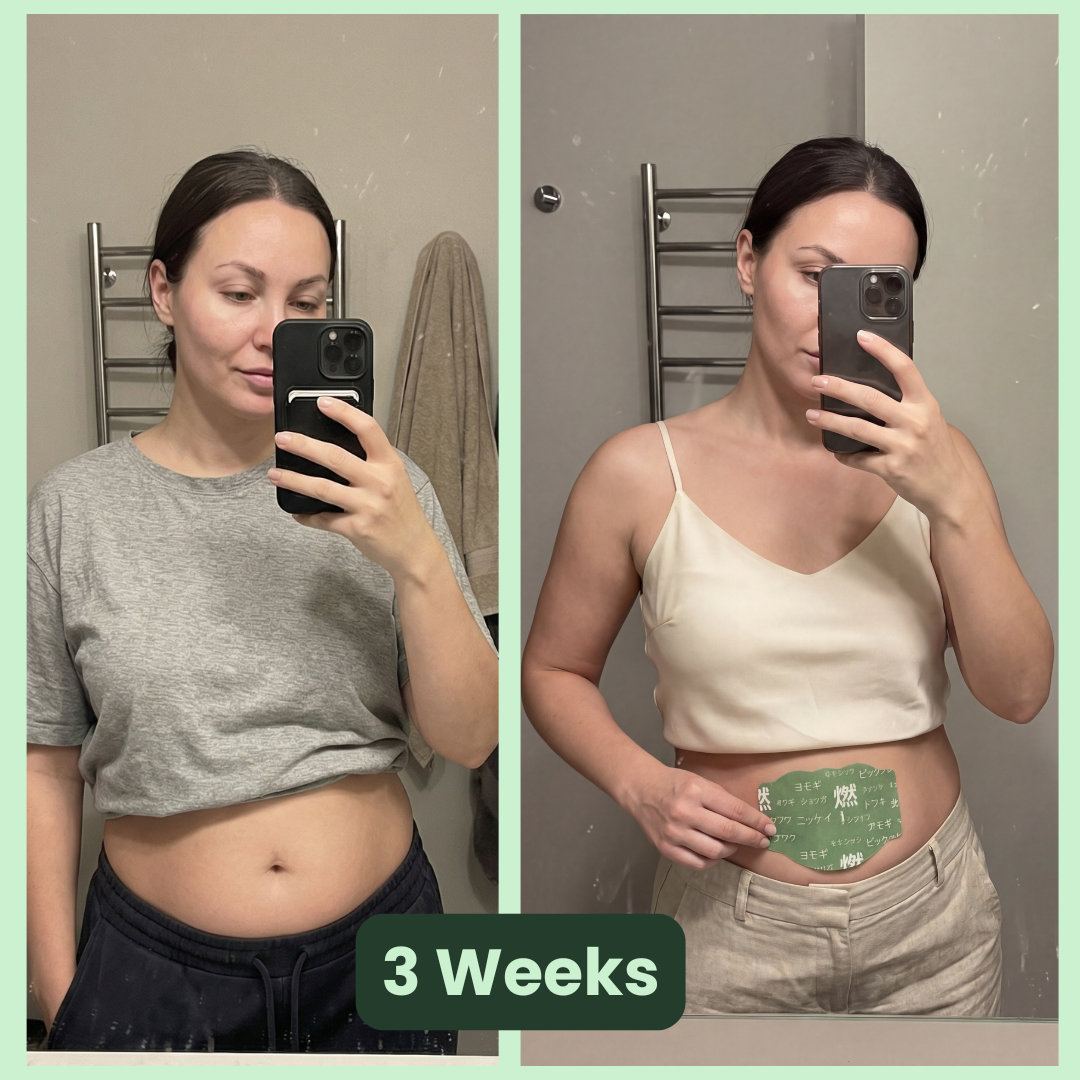 Japanese Slimming Patches – 5 Uses | Just Apply & Go, No Diet Stress