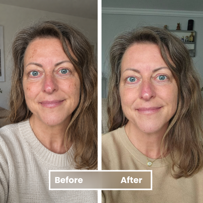 Get Your Even Skin Tone Back — Without Hours of Cover-Up