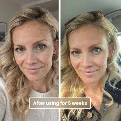 Get Your Even Skin Tone Back — Without Hours of Cover-Up